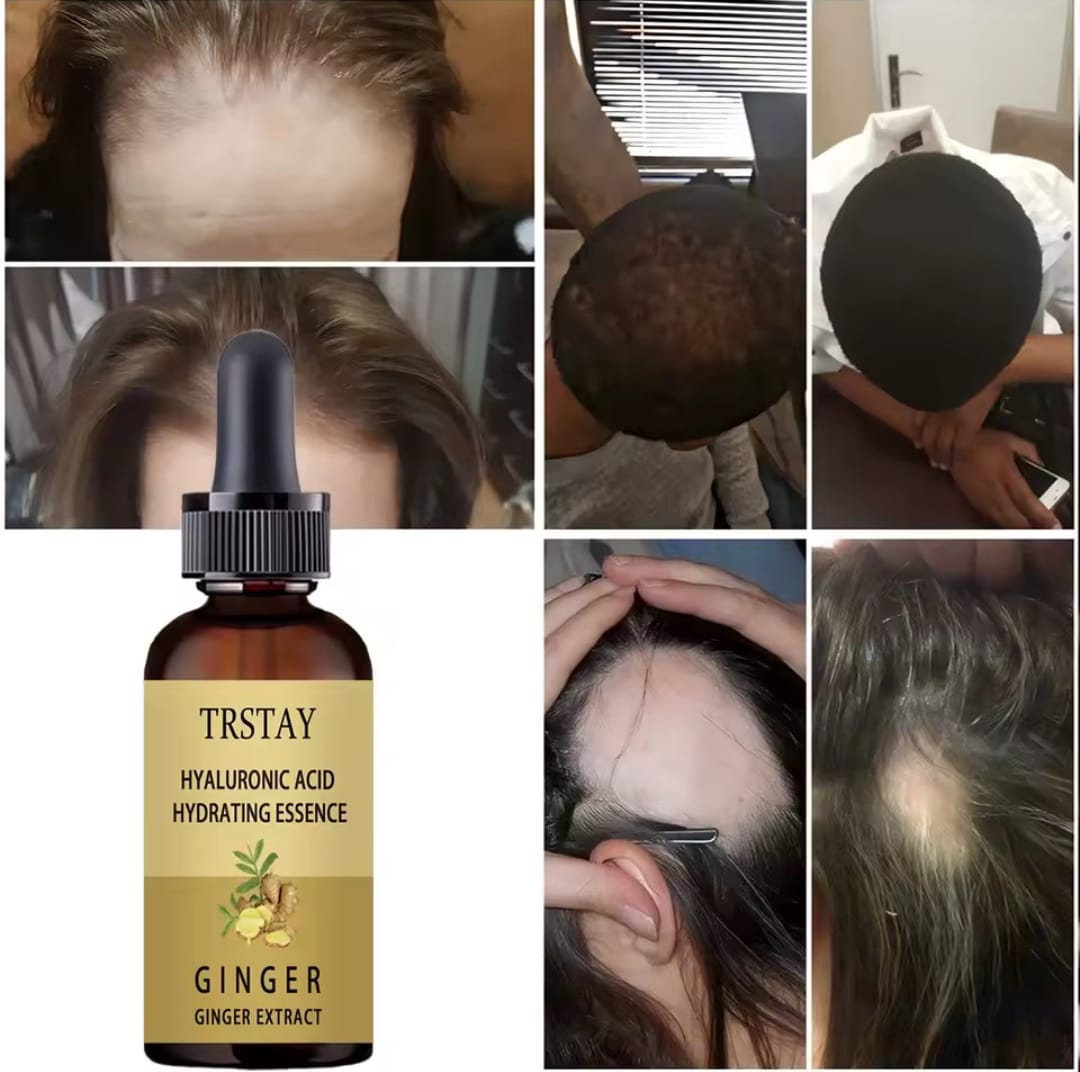 Hair growth serum