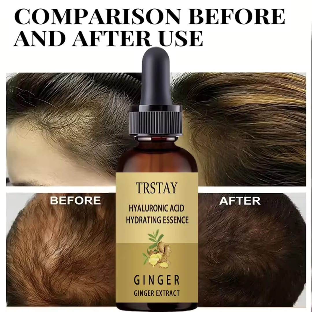 Hair growth serum